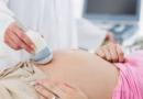 Каким может быть расположение плаценты при беременности, выясняем все возможные варианты